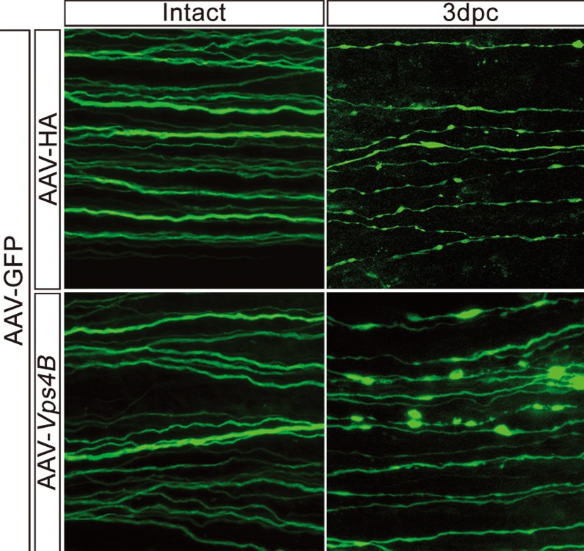 Integrity of the injured nerve is apparently more intact (bottom right) within three days after upregulation of Vps4 than that which have not been regulated (upper right).