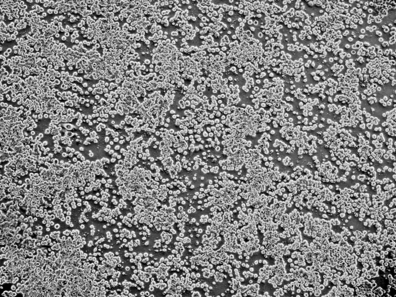 用 以 製 造 戊 型 肝 炎 疫 苗 的 昆 蟲 細 胞