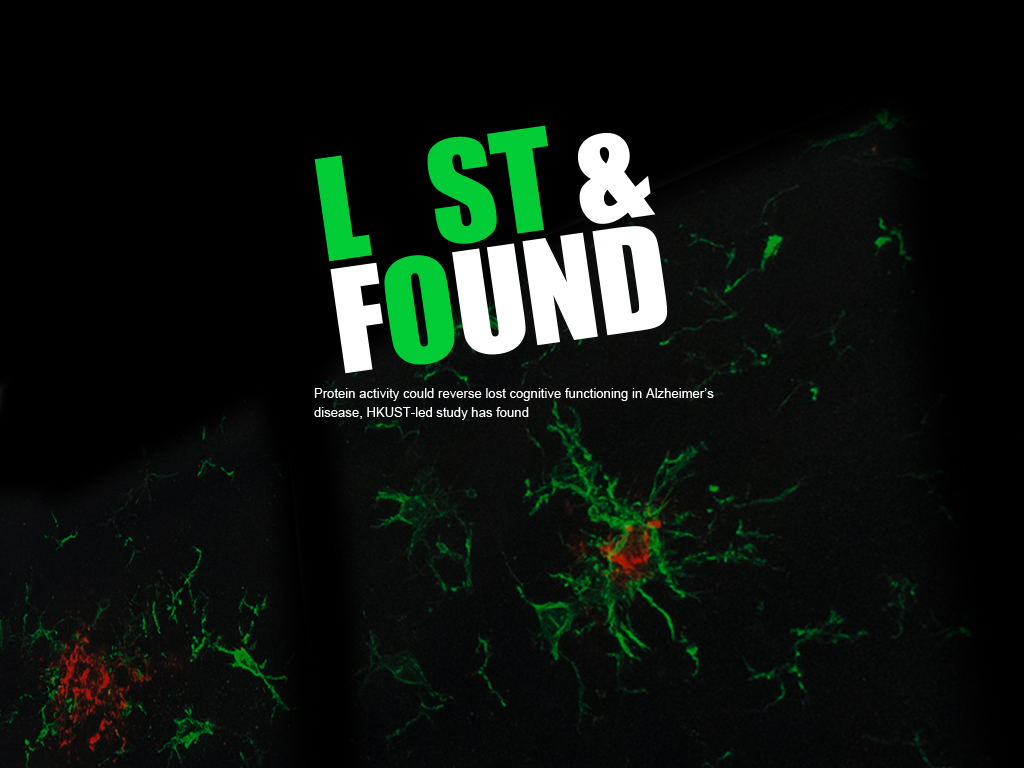 科大領導的研究發現蛋白質活動可望治療阿爾茲海默症認知障礙