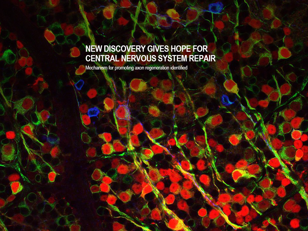 Mechanism for promoting axon regeneration identified