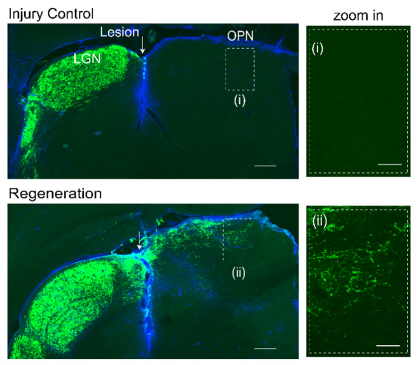 Figure 2: Regenerated axons cross the injury site and reinnervate the target brain region OPN.