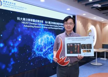 A research team led by Prof. QU Jianan, Professor of the HKUST Department of Electronic and Computer Engineering of the School of Engineering, has introduced a groundbreaking technique that can capture high-resolution images of the awake mice brain in a near non-invasive manner. The advancement promises deeper insights into human brain function in both healthy and diseased conditions.